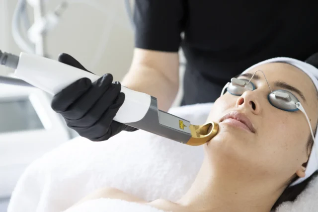 Innovative Laserbehandlung bei AESTHERA Dresden