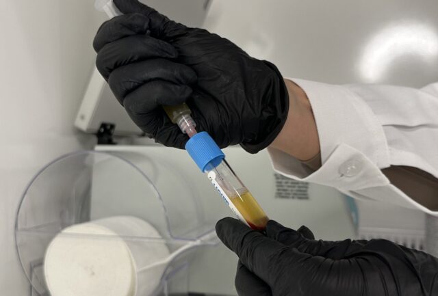 PRP Eigenbluttherapie Dresden